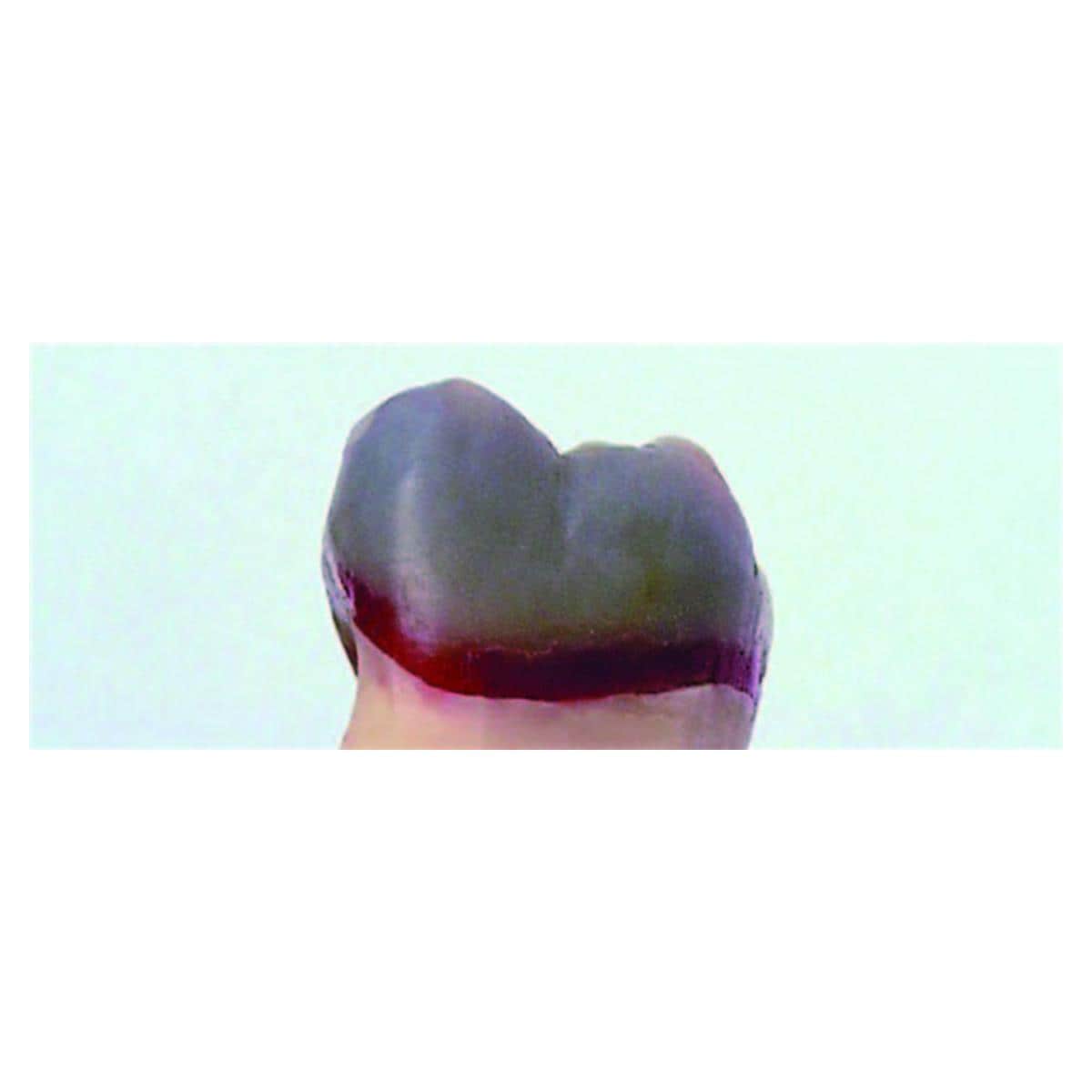 GEO cervicale RENFERT - Rouge transparent - La bote de 75 g