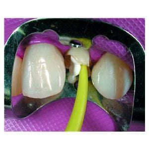 Paracore Automix COLTENE - Dentine - Coffret