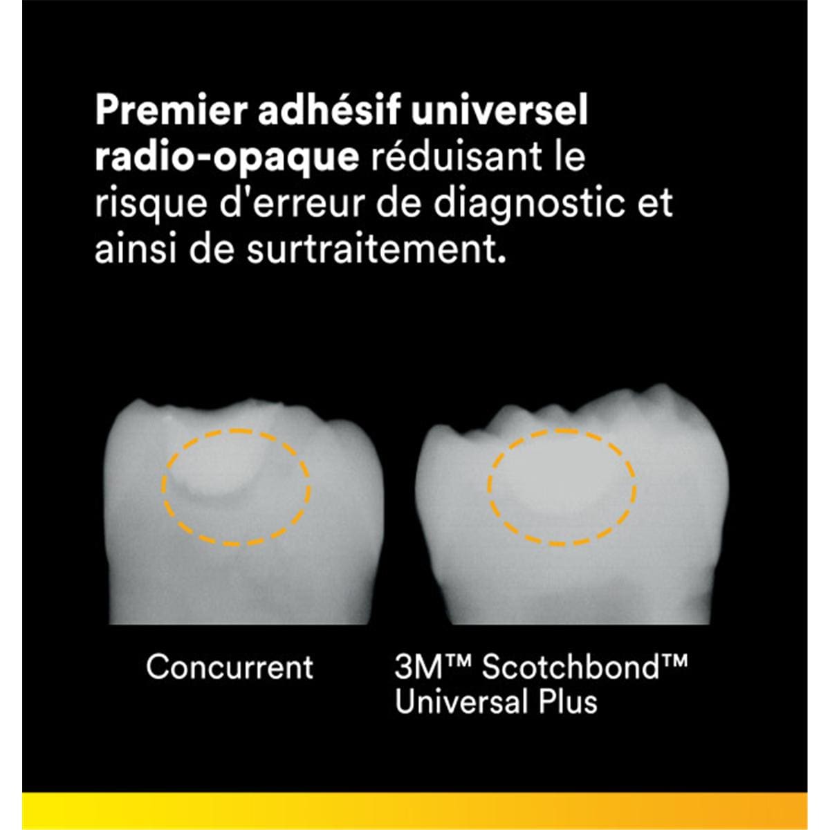 Scotchbond Universal Plus 3M - 5ml